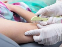 Những điều cần thiết phải biết về phương pháp cấy que tránh thai dưới da