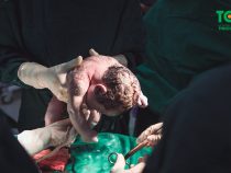 Cẩm nang bỏ túi các kinh nghiệm quý báu cho mẹ bầu đẻ mổ lần 1