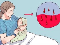 Những hệ lụy từ hiện tượng rong kinh sau sinh