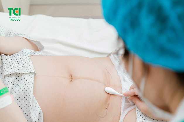 Chăm sóc vết mổ đúng cách để vết thương mau lành