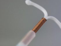Có nên siêu âm kiểm tra vòng tránh thai định kỳ?