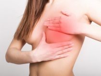 Viêm tắc tia sữa sưng đỏ khiến cho mẹ bỉm phiền phức, phải tiến hành sao?