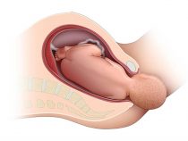Phụ nữ đẻ thường có mắc phải rộng ra không? thế đổi bộ phận sinh dục nữ sau sinh