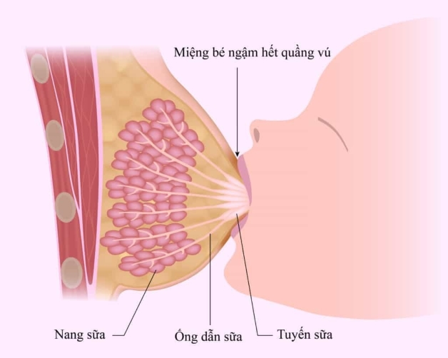 hay bị tắc tia sữa