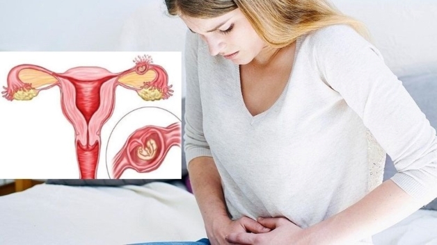 khi nào thai ngoài tử cung vỡ phải làm gì