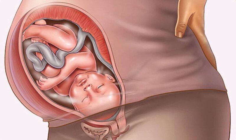Nhiễm trùng âm đạo là bệnh lý không hiếm gặp ở các bà mẹ đang mang thai