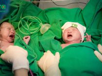 Mẹ sinh đôi đẻ thường thường hay đẻ mổ? Những điều mẹ bầu nên biết