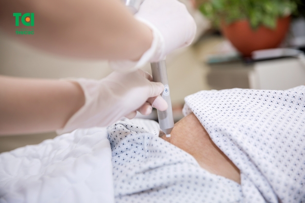 Chiếu Plasma giúp làm khô vết mổ nhanh, tránh nhiễm trùng cũng là một cách bảo vệ vết mổ sau sinh