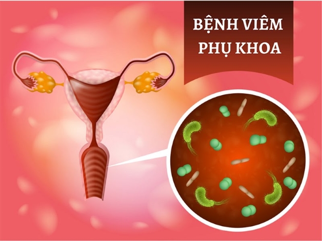 bệnh lây qua đường tình dục là viêm âm đạo
