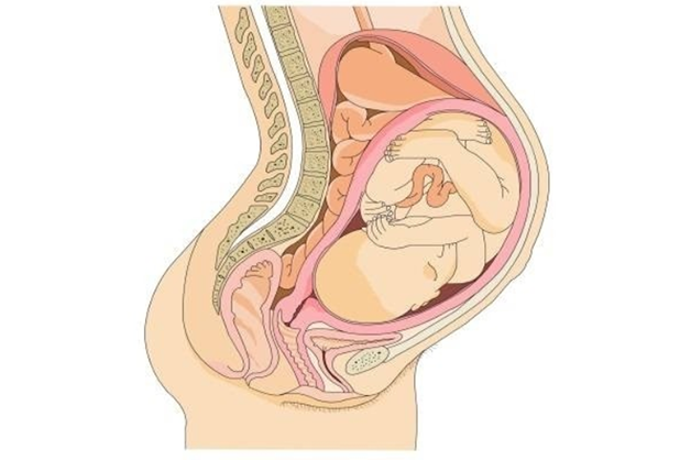 Tình trạng bất tương xứng đầu chậu khiến quá trình vượt cạn sinh thường trở nên khó khăn, gây ảnh hưởng tới cả thai phụ và thai nhi