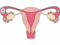 Những dấu hiệu chửa ngoài tử cung là như thế nào?