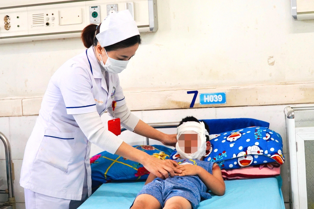 Bé trai 4 tuổi bỏng mặt do bóng bay phát nổ - 1 Bé trai 4 tuổi bỏng mặt do bóng bay phát nổ - 1