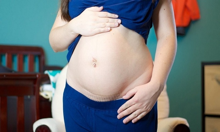 sinh mổ lần 2 có nguy hiểm không