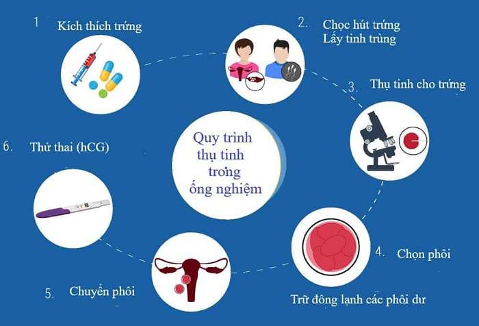 Tổng hợp kiến thức từ A đến Z về vô sinh hiếm muộn