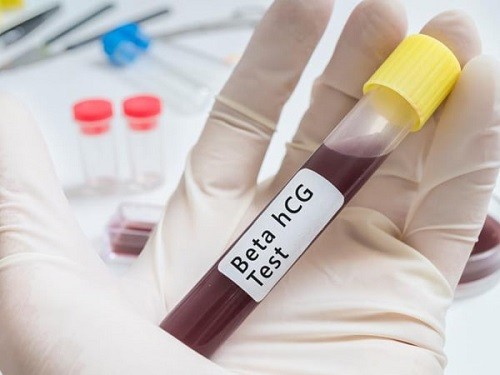 Xét nghiệm beta hcg là một trong những loại xét nghiệm dùng để chẩn đoán và xác định việc có thai