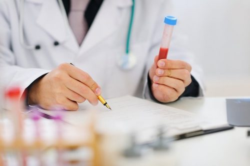 Xét nghiệm Double test giá bao nhiêu