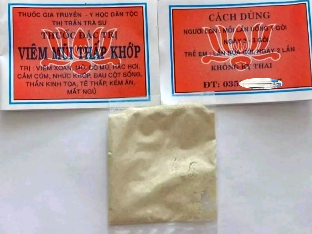 Mua thuốc trị viêm mũi trên mạng xã hội, bệnh nhân phải nhập viện cấp cứu - 1 Mua thuốc trị viêm mũi trên mạng xã hội, bệnh nhân phải nhập viện cấp cứu - 1