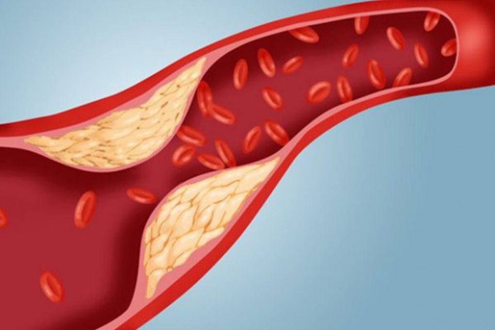 2 bệnh thường gặp sau Tết, nguy hiểm nếu không điều trị sớm - 2