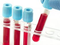 Có nên xét nghiệm máu khi mang thai thường hay không?
