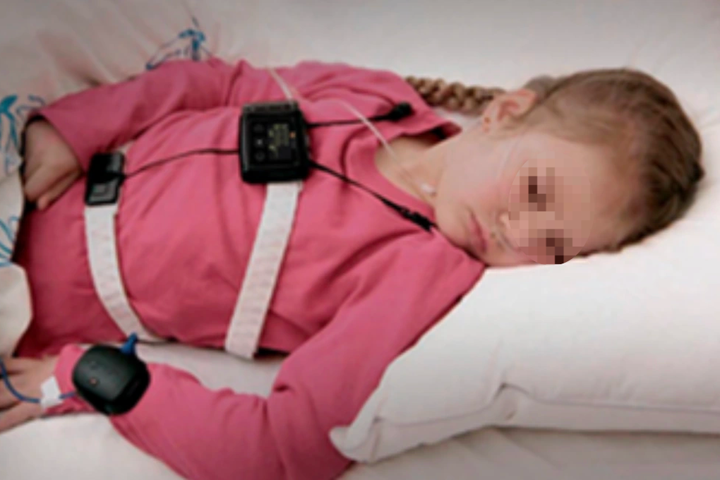 Cha mẹ chú ý căn bệnh ngưng thở lúc ngủ ở trẻ, di chứng rất nghiêm trọng - 3
