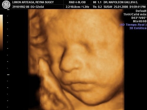 Các mốc siêu âm thai 4D ghi lại những hình ảnh chuyển động rõ nét của thai nhi.