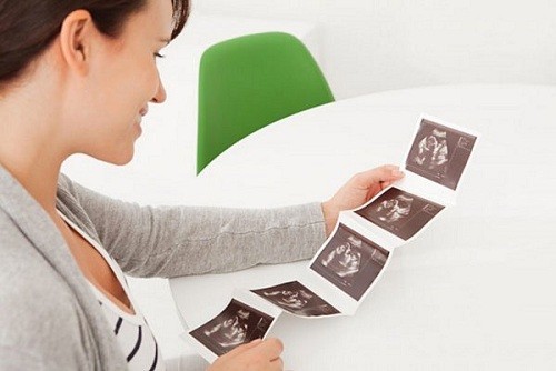 Siêu âm ghi lại sự phát triển của thai trong bụng mẹ.